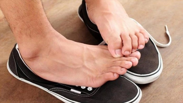 Điểm chung nhất dẫn đến mùi chân và sự ra mồ hôi nhiều trên da là do đeo giày bít.